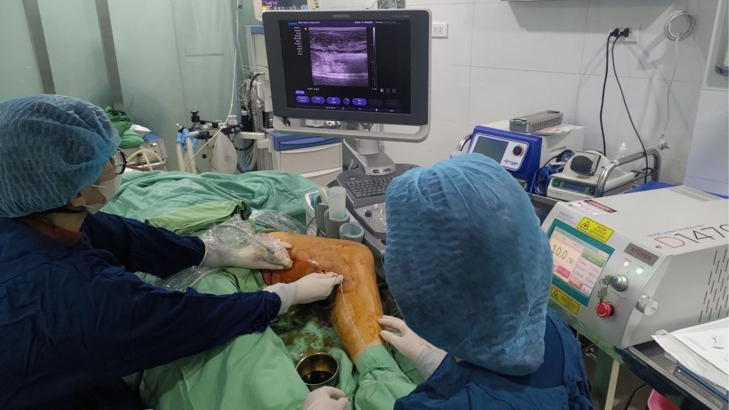 các mức độ suy giãn tĩnh mạch