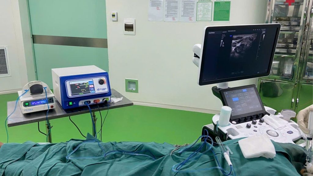 điều trị u tuyến giáp bằng sóng cao tần radio